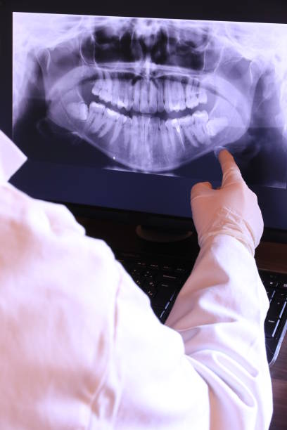 Best Emergency Dentist for Lost Fillings or Crowns in Hazleton, PA
