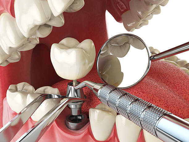 Best Emergency Dentist for Knocked-Out Tooth in Hazleton, PA